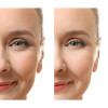Ser antirid, Lifting Serum, Life Care®